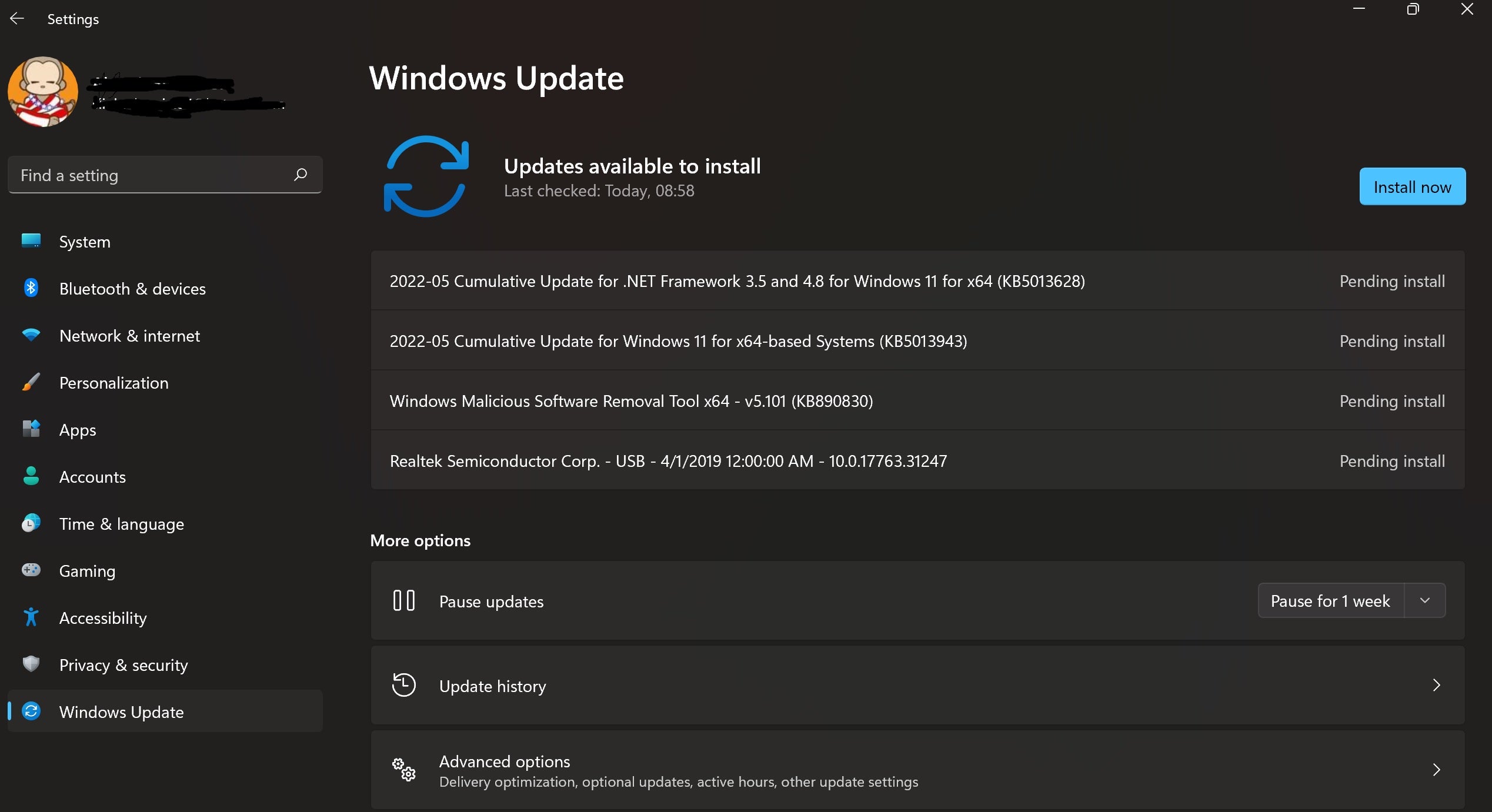 Vista de configuración directa de actualización de Windows