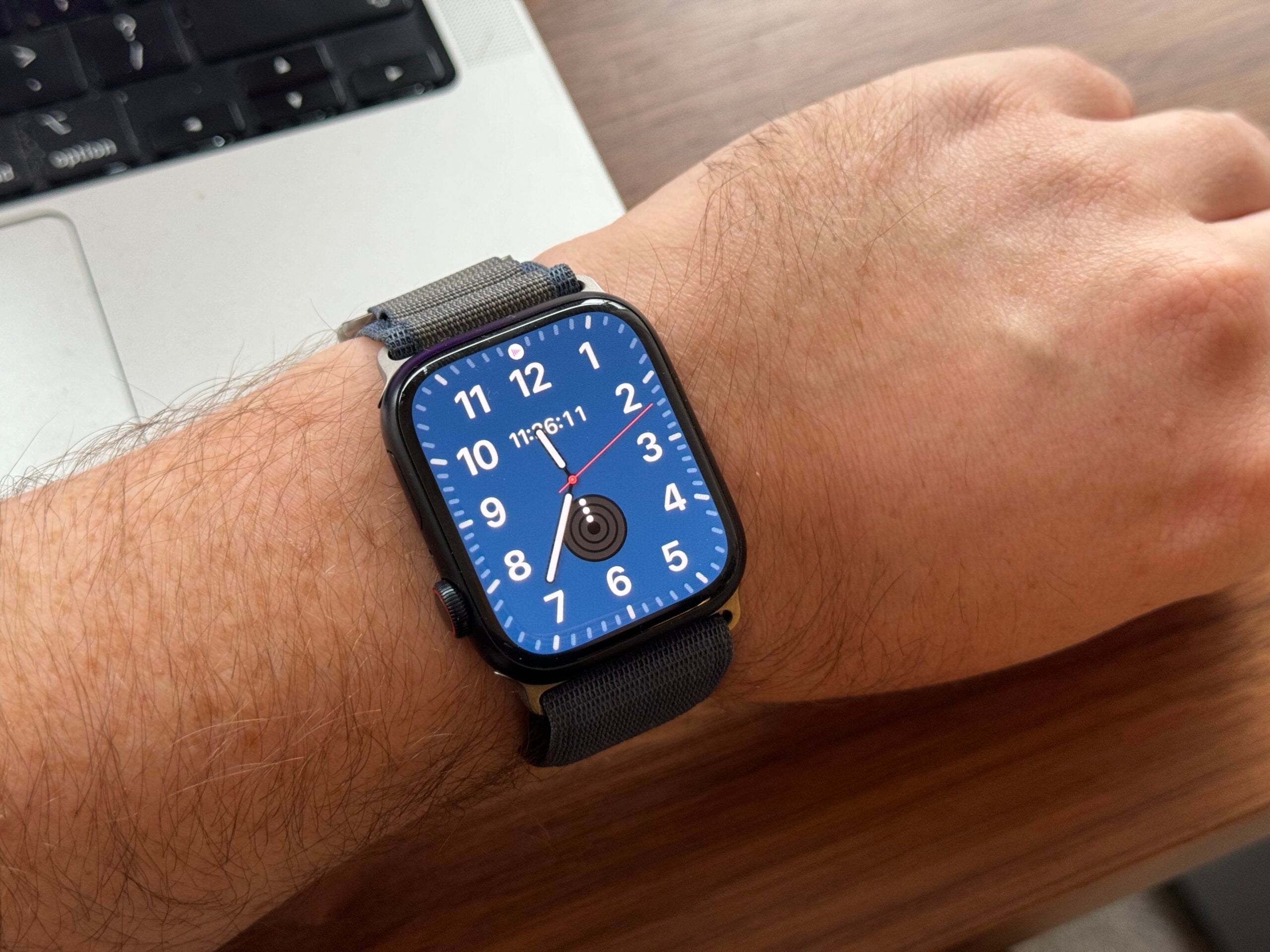 esfera del reloj en el Apple Watch