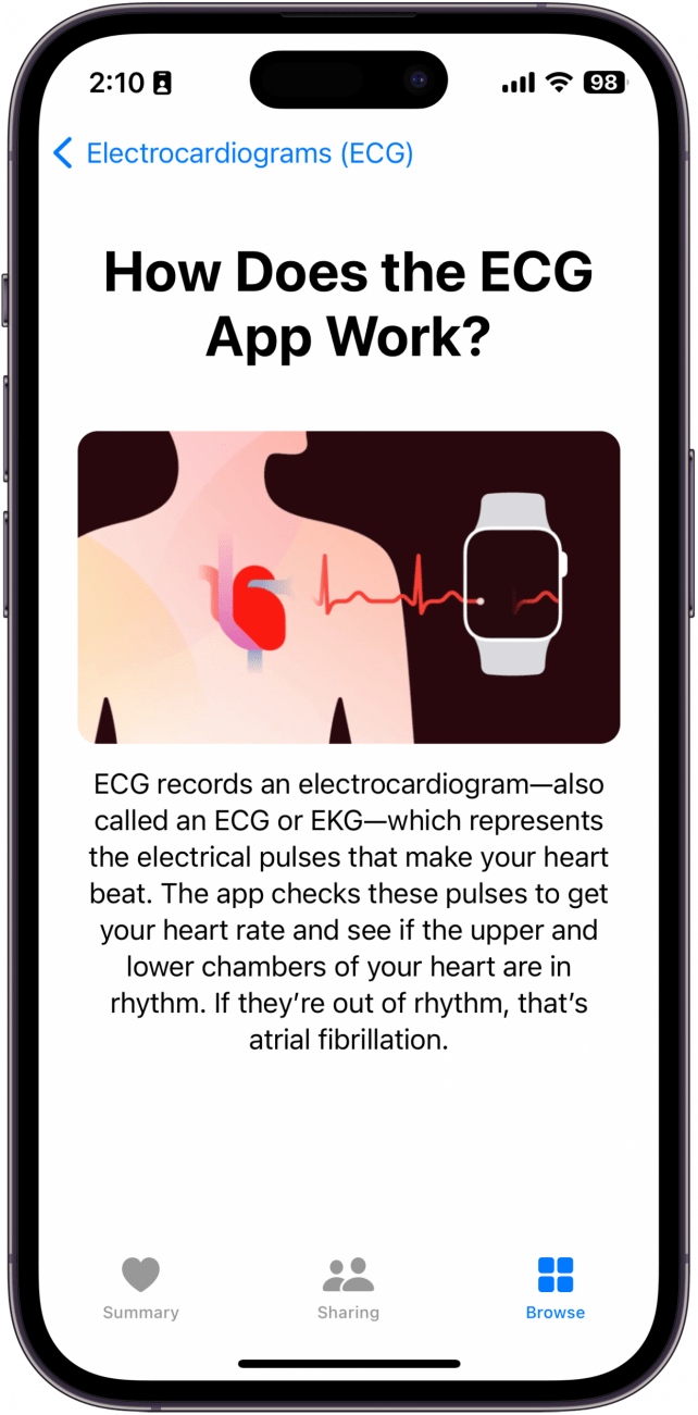 Pantalla de ECG de la aplicación Apple Health que muestra la pregunta, 